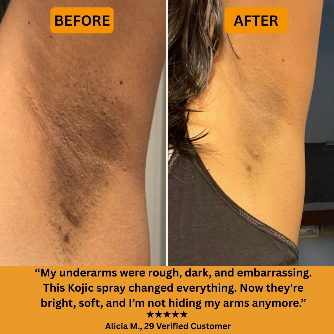 Peel Shot - Kojic + Turmeric Body Spray